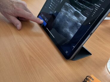 Přenosný ultrazvuk pro&nbsp;mobilní hospic